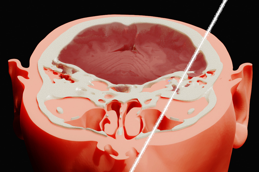 Reconstru&ccedil;&atilde;o digital do c&eacute;rebro do f&iacute;sico Anatoli Bugorski.