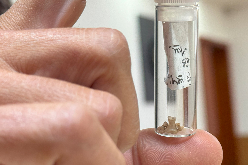 Fotografia de ossos da mão de Z. rinponche