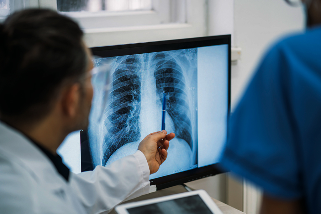 Por que tantos millennials estão tendo câncer?