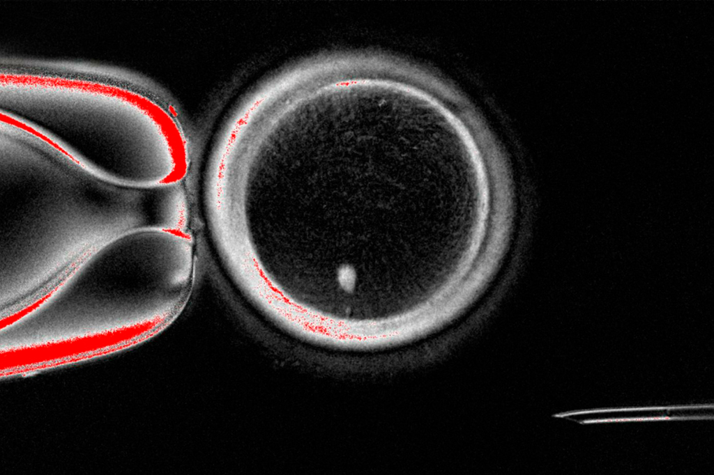 Pela primeira vez, cientistas criam óvulos fecundáveis a partir de células da pele humana