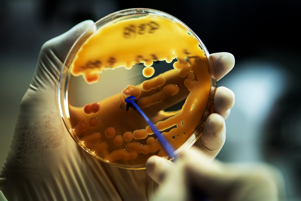 Cientistas descobrem antibiótico até 100 vezes mais potente que compostos atuais