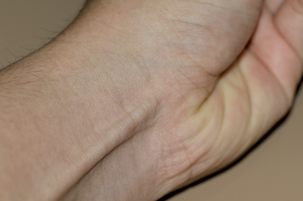 A evolução está fazendo este músculo desaparecer dos nossos braços. Descubra se você ainda o tem