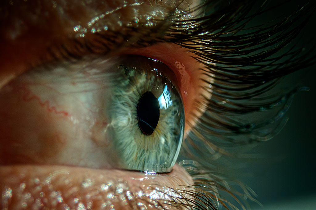 “Trend” nas redes sociais, raspar os cílios pode causar lesões nos olhos