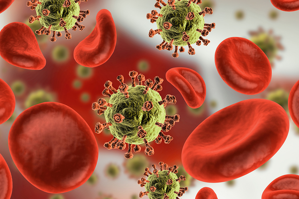 Cientistas confirmam 7º caso de cura do HIV, desta vez com técnica inovadora