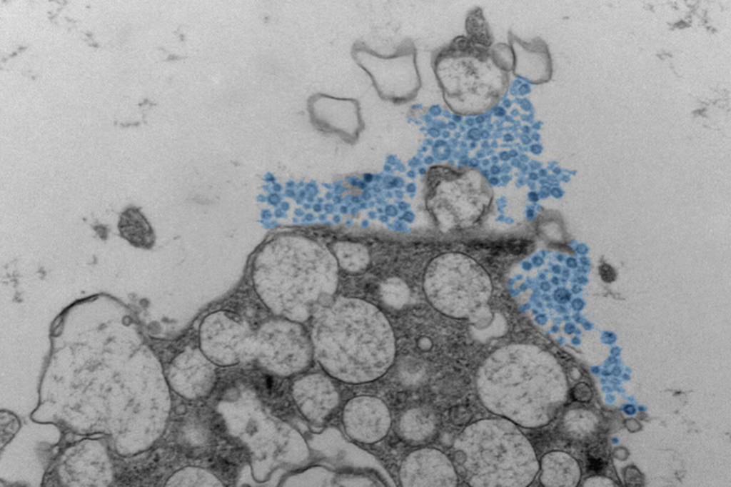 Fotografia da micrografia eletr&ocirc;nica mostrando uma c&eacute;lula epitelial nasal humana liberando rinov&iacute;rus (azul).
