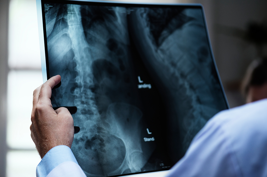 Fotografai de um médico com película de raio x de um paciente.