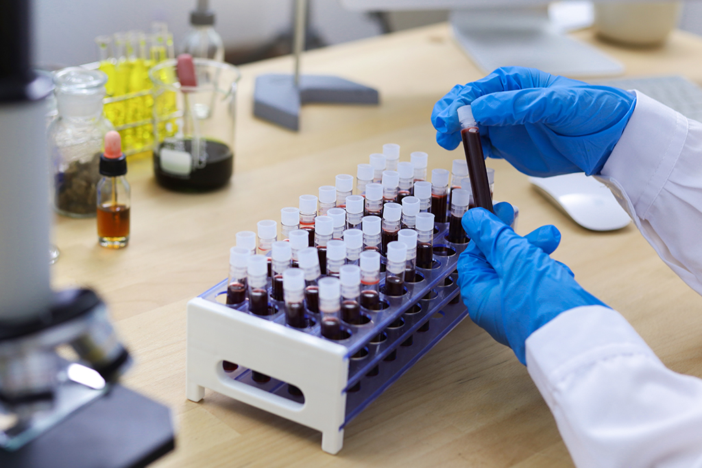 Fotografia de ampolas de sangue.