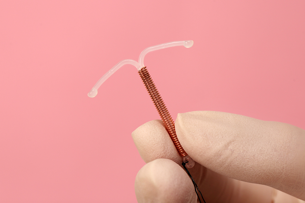 Fotografia de um diu.