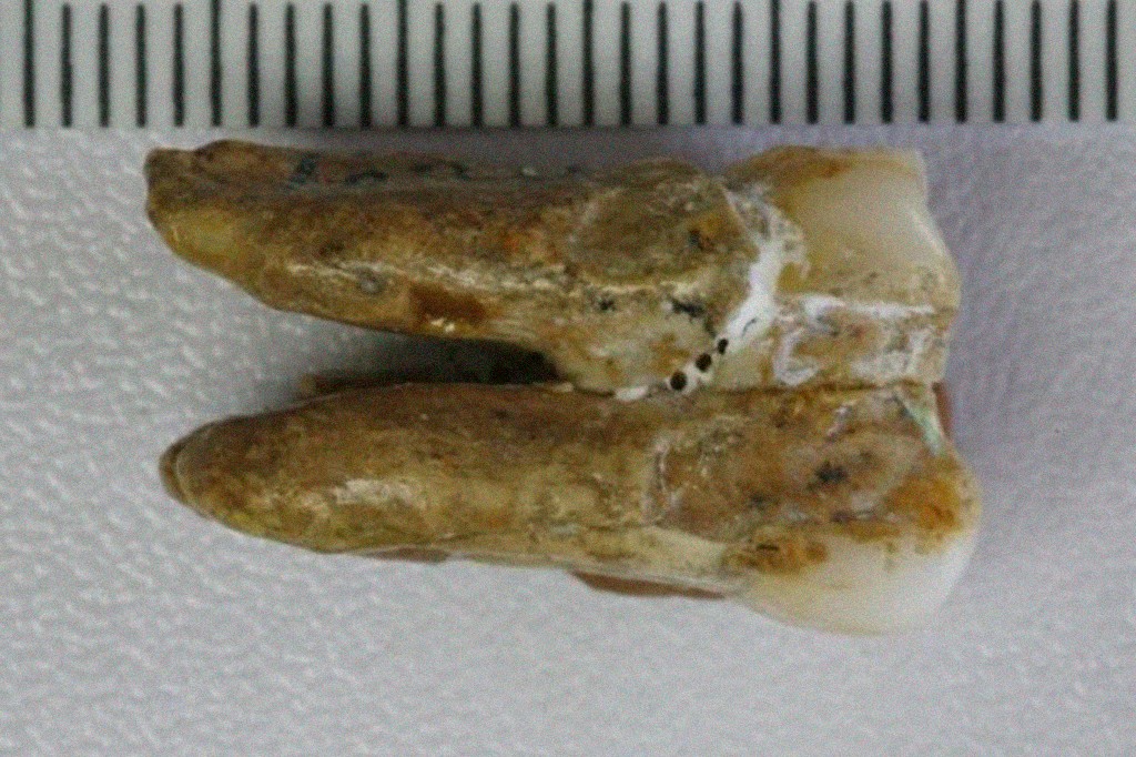 Dente molar de um Homo erectus, com duas raízes e coroa amarelada, exibindo desgaste e manchas escuras, sobre fundo branco com régua milimetrada no topo