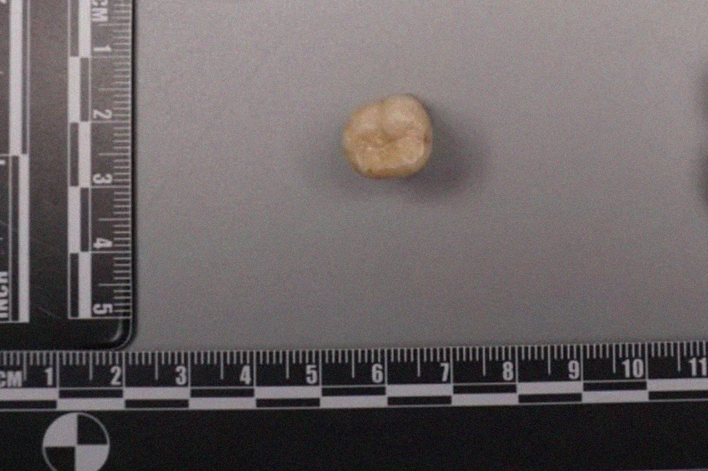 Um dente do Homo erectus, irregular e arredondado, posicionado sobre uma superf&iacute;cie cinza, com r&eacute;guas de medi&ccedil;&atilde;o em cent&iacute;metros e polegadas nas bordas inferior e esquerda
