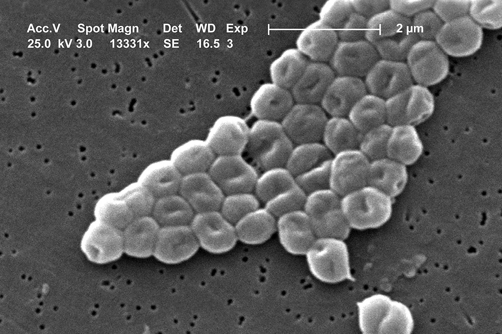 Micrografia eletrônica de varredura mostrando um aglomerado de células bacterianas esféricas, cinza-claras, com depressões centrais, sobre uma superfície escura e porosa. Uma barra de escala indica 2 micrômetros.
