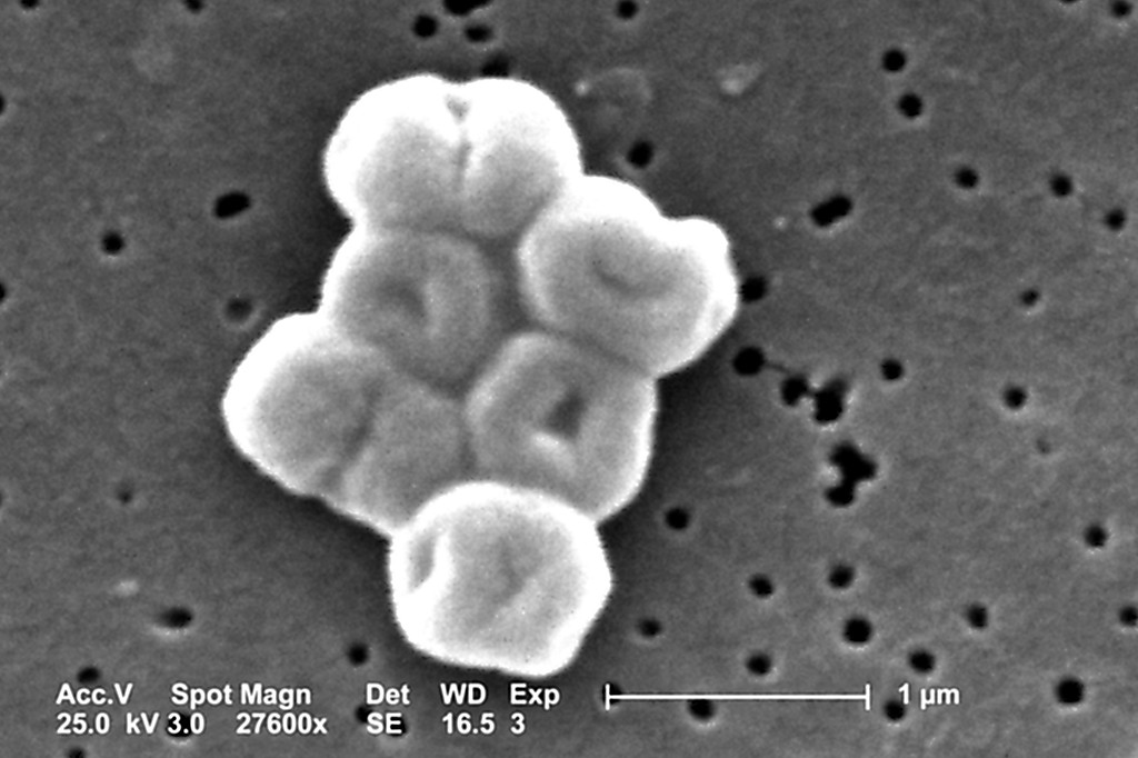 Micrografia eletr&ocirc;nica em preto e branco de um aglomerado de sete c&eacute;lulas esf&eacute;ricas claras, com centros mais escuros, sobre uma superf&iacute;cie escura pontilhada por pequenos orif&iacute;cios. Uma barra de escala indica 1 micr&ocirc;metro