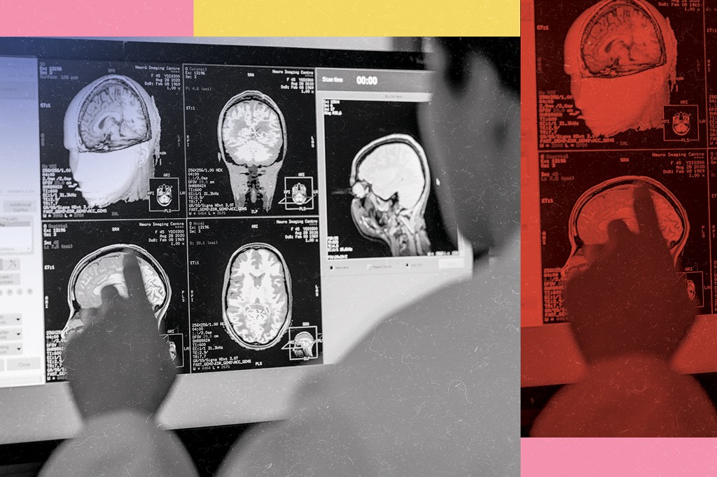 Pessoa de costas, com a mão apontando para uma tela de computador exibindo múltiplas imagens de ressonância magnética do cérebro em tons de cinza, com dados médicos e um cronômetro digital. O lado direito da imagem tem um filtro vermelho.